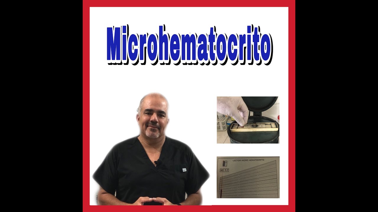 Hematocrito: Como realizar el microhematocrito en tubo capilar