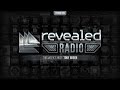 Revealed Radio 035 - Hosted by Toby Green 