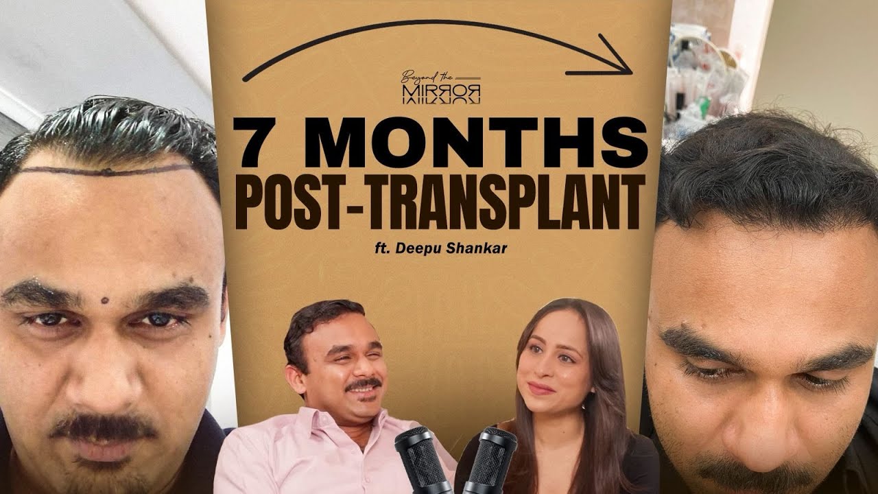 Deepu Shankar on his hair transplant decision in Dubai, full interview