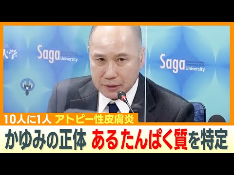 接触皮膚炎について詳しく解説