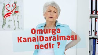 Omurgada Kanal Daralması nedir? - BeyinveSinir