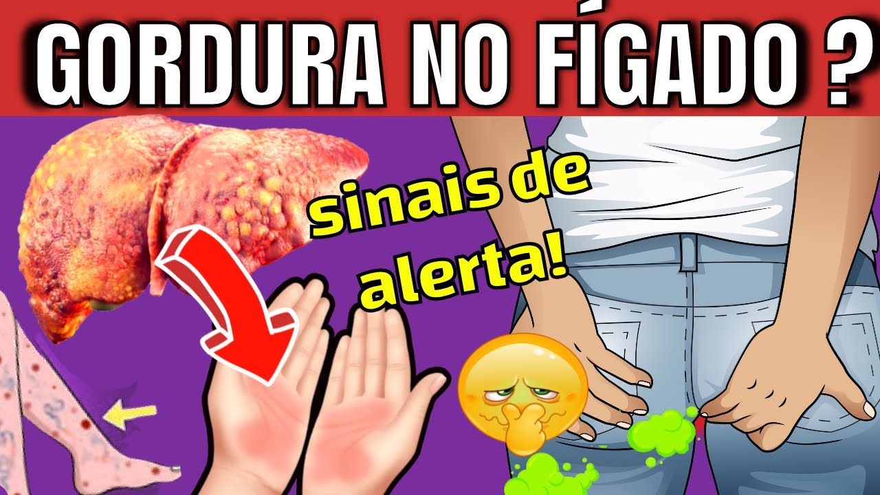 8 SIGNS THAT INDICATE FAT IN THE LIVER | INITIAL SYMPTOMS OF FATTY LIVER DISEASE (silent threat)