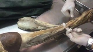 [Anatomy] lower limb (spotting) revision part 2