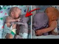 Mom puts the baby to the dying Twin and five minutes later a real Miracle happens... | PLOT