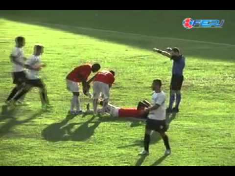 America 2x0 Queimados - Série B 2014 - Taça Corcovado