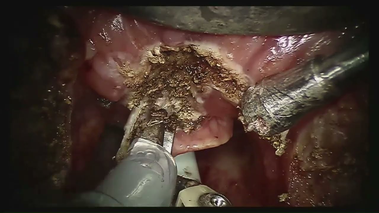 Adriano Santana Fonseca-12