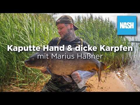 Kaputte Hand & dicke Karpfen! - Angler fängt riesige Karpfen mit gerissener Sehne! - NASH TV