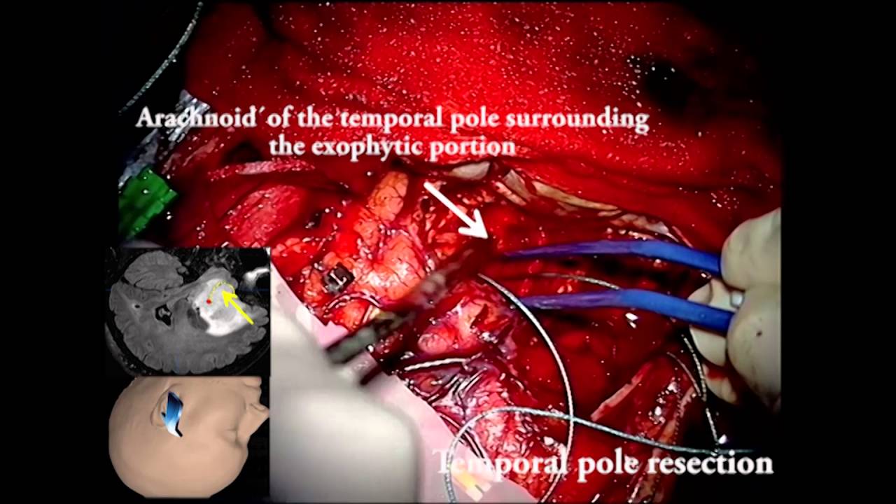 Juan Martino Gonzalez-2