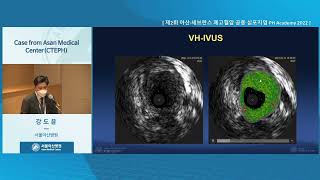 제2회 아산·세브란스 폐<b>고혈압</b> 공동 심포지엄 PH Academy 2022 : Case from Asan Medical Center(CTEPH) 미리보기 썸네일