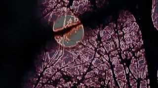 MissKittin - Professional Distortion From: marinaannhantzis  | Feb 6, 2009  | 17,438 views