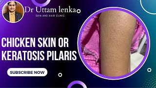 Chicken skin treatment or keratosis pilaris | small hard bumps on arm /katha brana / Dr Uttam Lenka