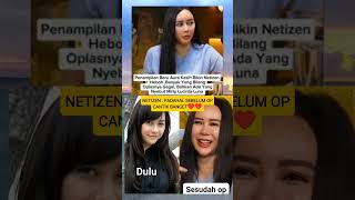 Download lagu wajah aura kasih setelah oplas #trending #viral mp3 Download lagu wajah aura kasih setelah oplas #trending #viral mp3