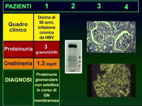 Prostata molto succo Trattamento della prostatite quanto costi
