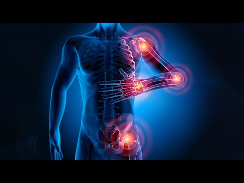 Infections & rheumatic diseases