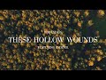 Rob Lydon - These Hollow Wounds