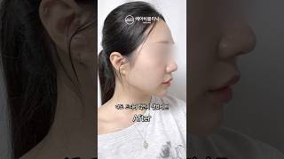 쫀쫀매끈 V라인 피부 되찾은 후기