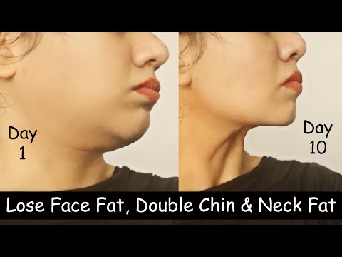 Lose Double Chin & Face Fat in 10 Days - Lose Neck Fat | Slim Face Exercise | Double Chin Exercise