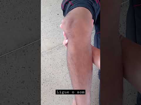 Vídeo: Como colocar joelho no lugar: perguntas e cuidados