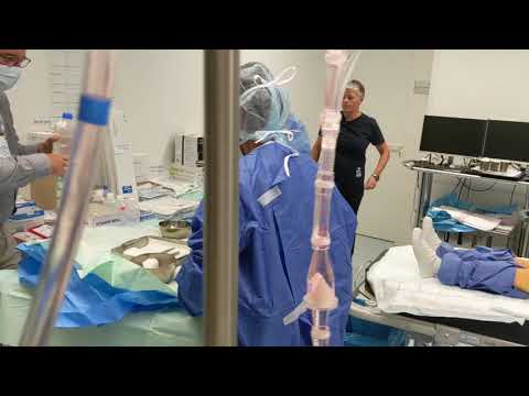 ECMO assisted cardiopulmonary resuscitation