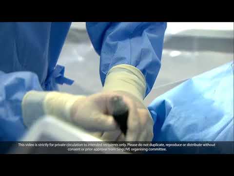 Intravascular Lithotripsy - Singapore LIVE 2020