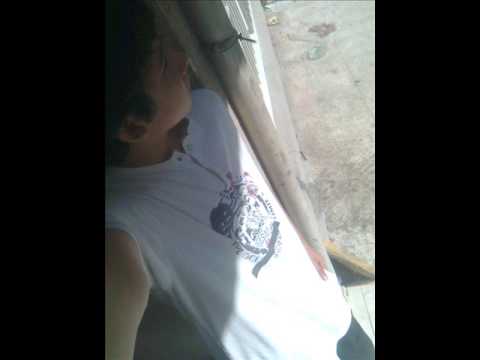 [S]erhat271 [A]rpes [R]itmikAnestezi