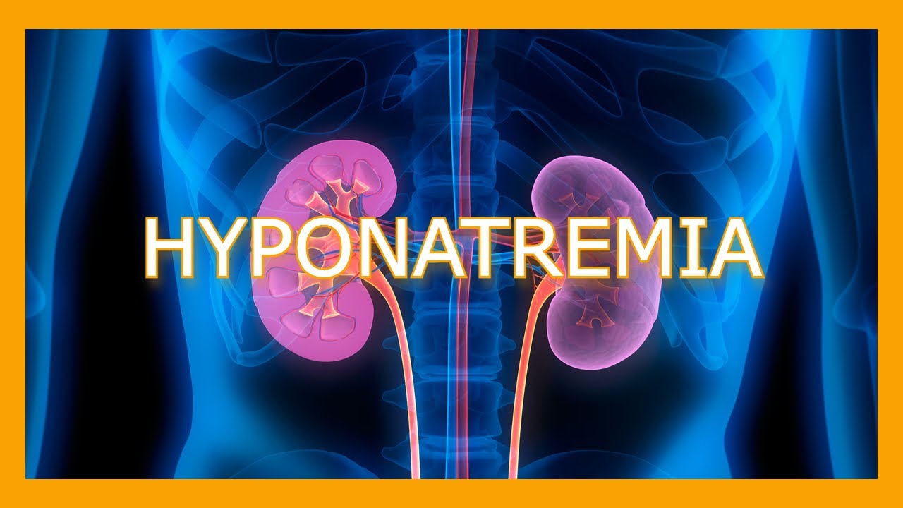 Hyponatremia