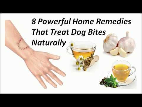 8 Powerful Home Remedies That Treat Dog Bites Naturally