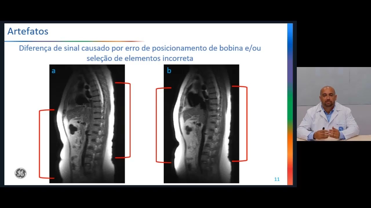 A arte de solucionar os Artefatos em Ressonância Magnética (Parte 1) | GE HealthCare Brasil