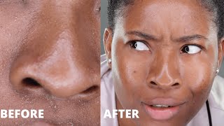 How I got Rid of my Neutrogena skin allergy