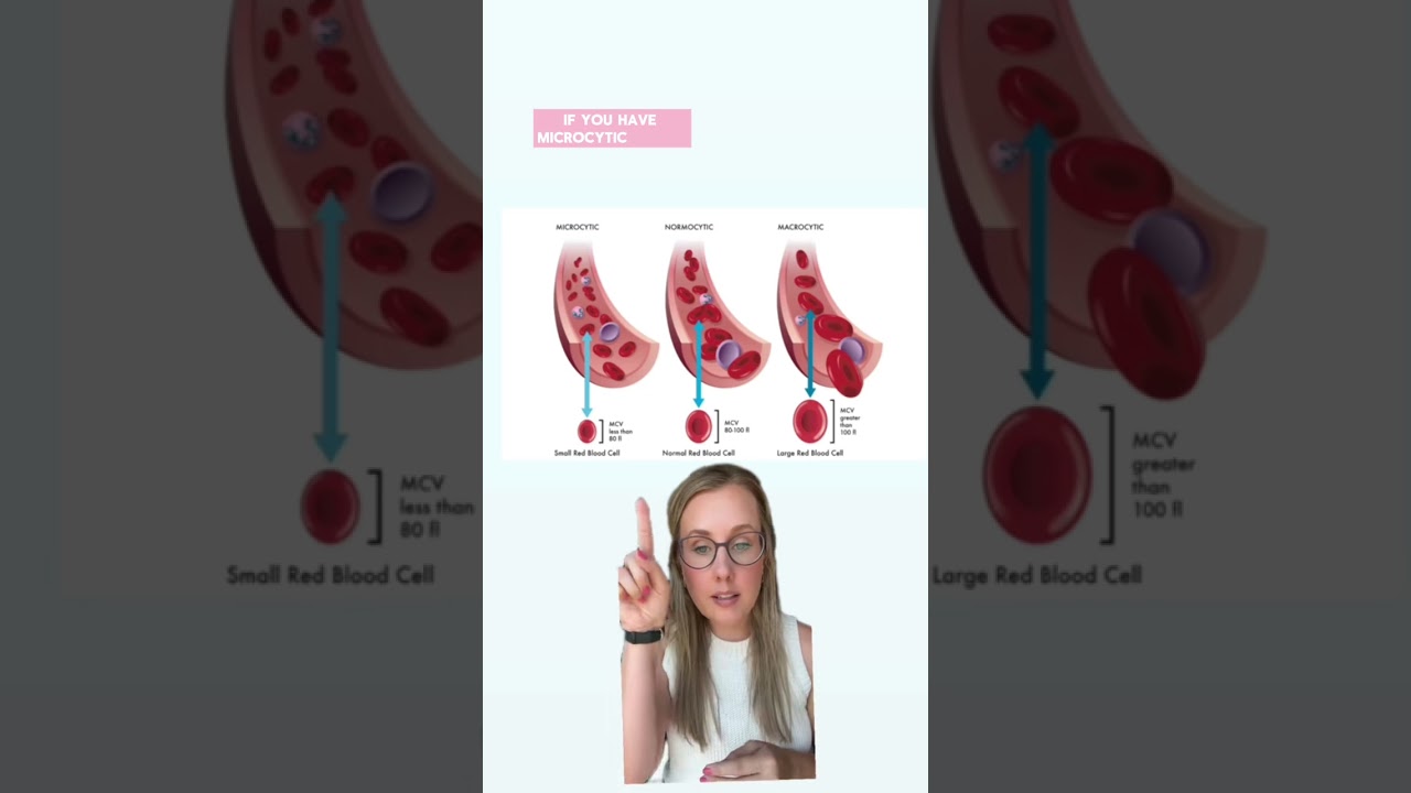 huh, guess they did teach us nutrition in medical school 😉 #anemia #irondeficiencyanemia