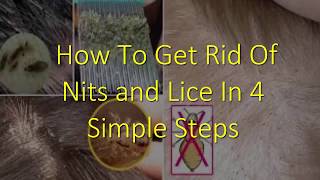 How To Get Rid Of Nits and Lice In 4 Simple Steps
