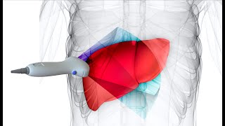 Introducing Velacuru2122: The First Handheld 3D Liver Health Assessment Tool