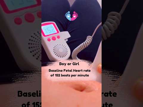 Fetal Heart Rate of 152 bpm, Boy or Girl? ❤️ #heartbeat #heartsound #genderreveal
