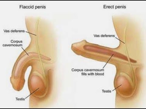 Problemas De Ereccion y Soluciones Caseras – Como Mantener La Ereccion