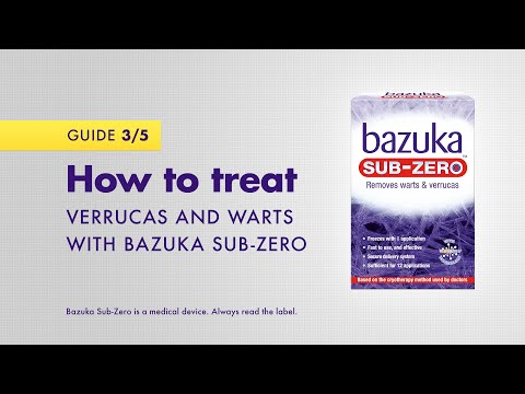 How to treat verrucas and warts with Bazuka Sub-Zero