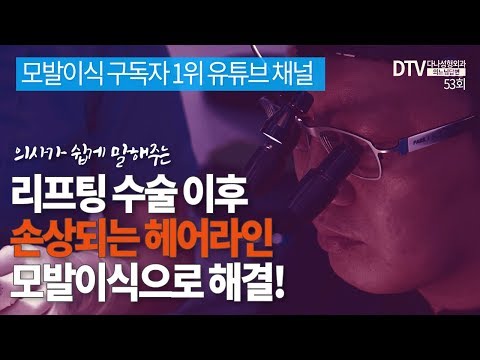 의느님답변????ㅣ의느님답변 53회 리프팅 이후 손상되는 헤어라인 모발이식으로 해결