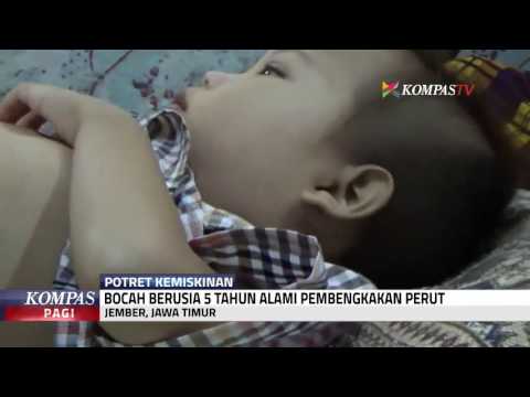 Bagaimana untuk mengambil Turboslim drainase untuk wanita Anita Lutsenko bagaimana untuk menyingkirkan selulit