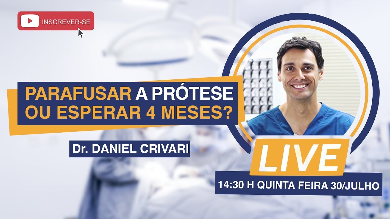 Parafusar a Protese ou Esperar 4 Meses? (Live) 30/07 14:30 H