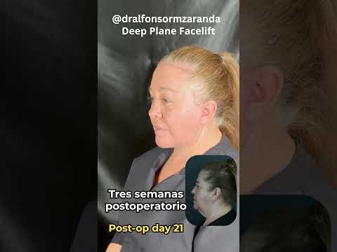 Alfonso Ramírez Aranda-59