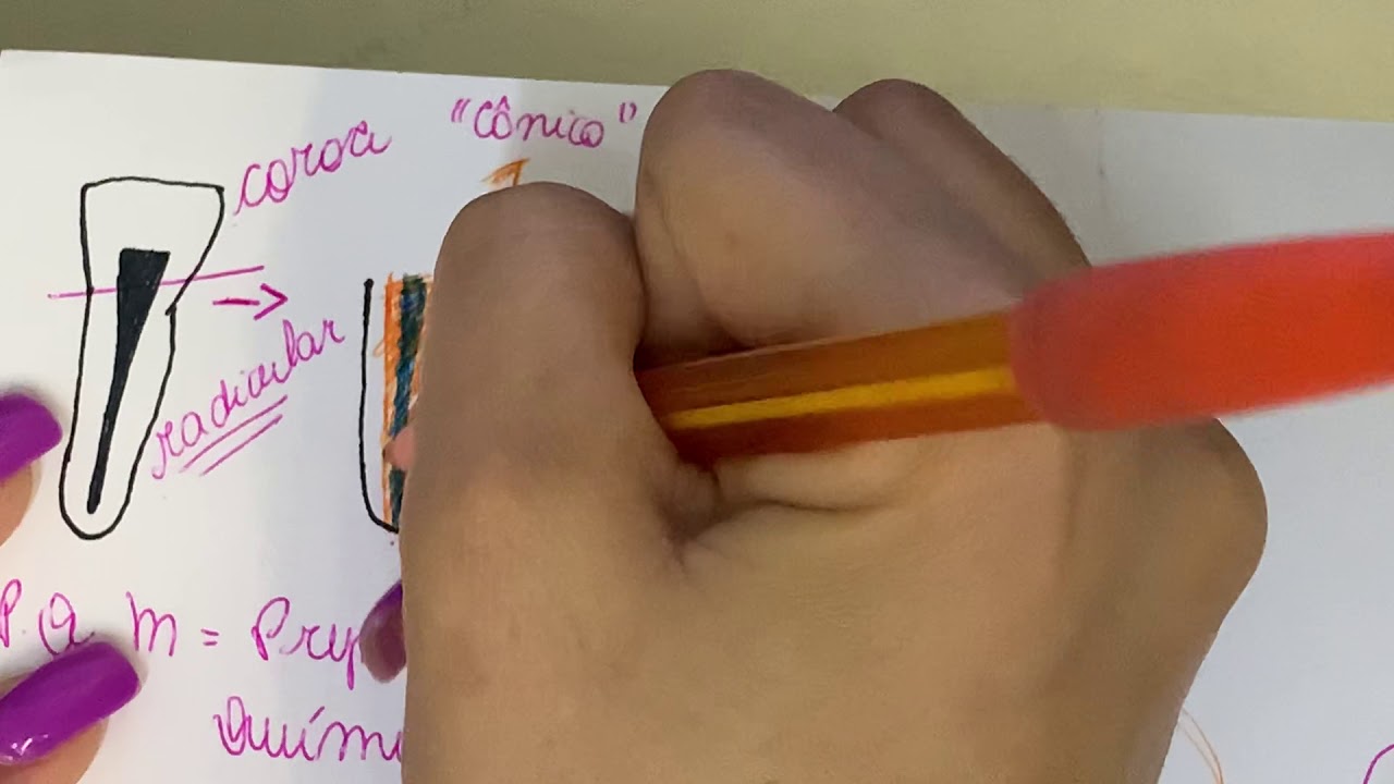 Passo a passo da instrumentação endodôntica.