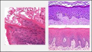 Aula de histologia da Cavidade Oral - Parte 1