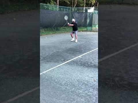 Forehands before CMC surgery.