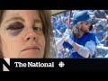 #TheMoment a Jays fan got love from team after taking a foul ball in the face