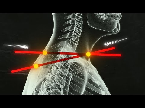 The JFK Assassination: The Autopsy Controversy