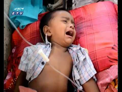 বরগুনায় বেড়েছে ডায়রিয়ার প্রকোপ