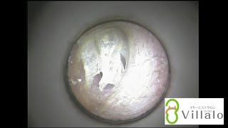 耳掃除動画vol.12「耳垢の壁を突破せよ！」