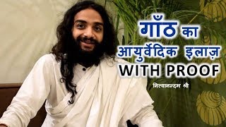 गाँठ | LIPOMA KA AYURVEDIC TREATMENT WITH PROOF BY NITYANANDAM SHREE - Download this Video in MP3, M4A, WEBM, MP4, 3GP