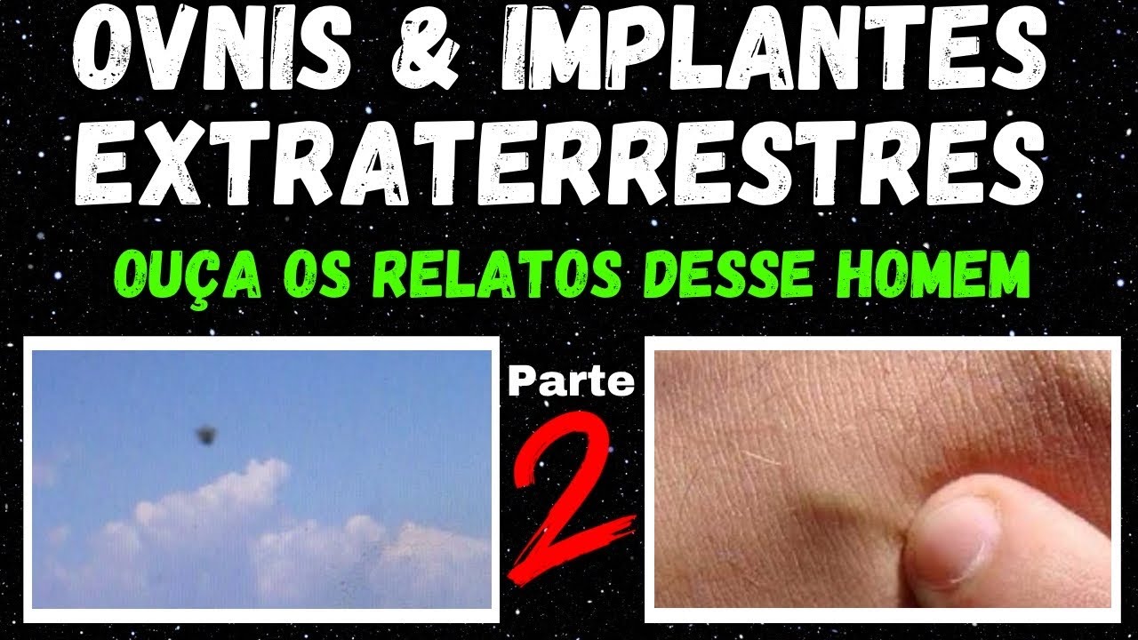 OVNIs & IMPLANTES EXTRATERRESTRES- OUÇA OS RELATOS DESSE HOMEM/ Pt02