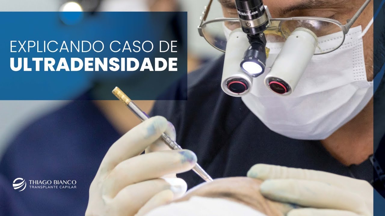 Explicação Caso de Ultradensidade - Dr. Thiago Bianco
