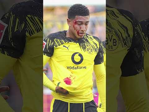 Video Thumbnail: BUNDESLIGA: Heftiger Blut-Crash! Bellingham mit Platzwunde! BVB - Union Berlin | Highlights #bl